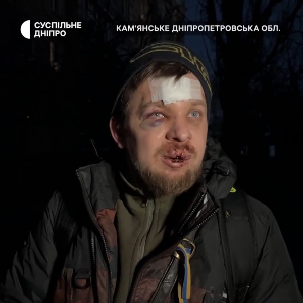 Операція &laquo;Барабаш&raquo;: хто і з якою метою пустив кров активісту в Кам&rsquo;янському?