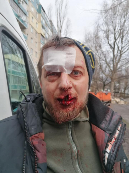 В Каменском избили волонтера: подробности